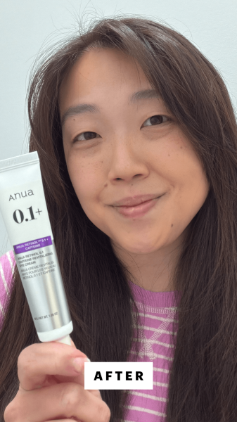 Lee after applying the Anua Retinol 0.1 Caffeine Revitalizing Eye Cream